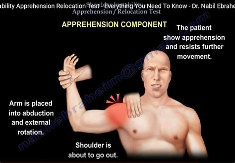 the apprehension and relocation test for shoulder labral tear|shoulder strengthening after exam.